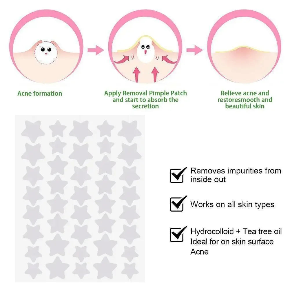 Soverell Star Patches — Hydrocolloid Acne Patches