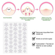 Soverell Star Patches — Hydrocolloid Acne Patches